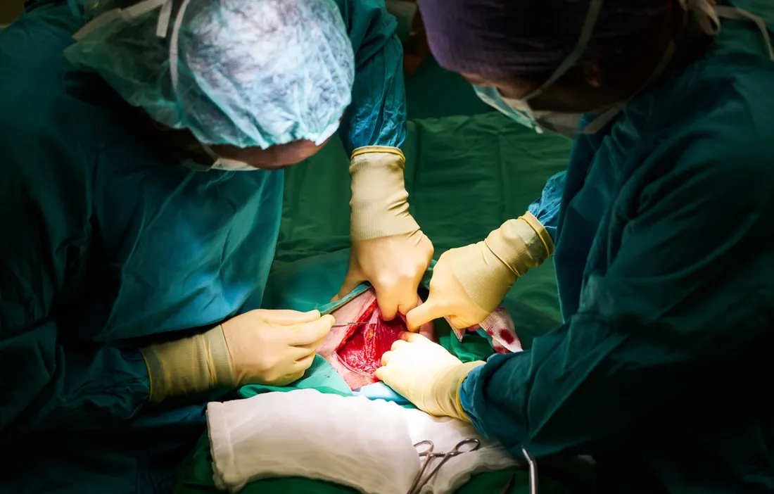 Première mondiale : un coeur de porc greffé sur un humain